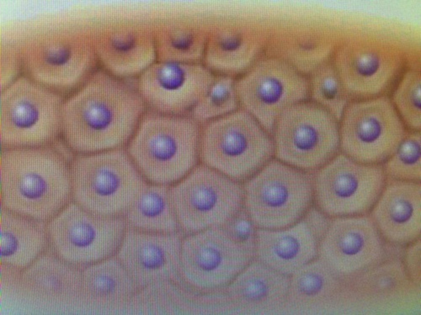 <p>(type of cell) irregularly angular shapes, multiple sides</p>