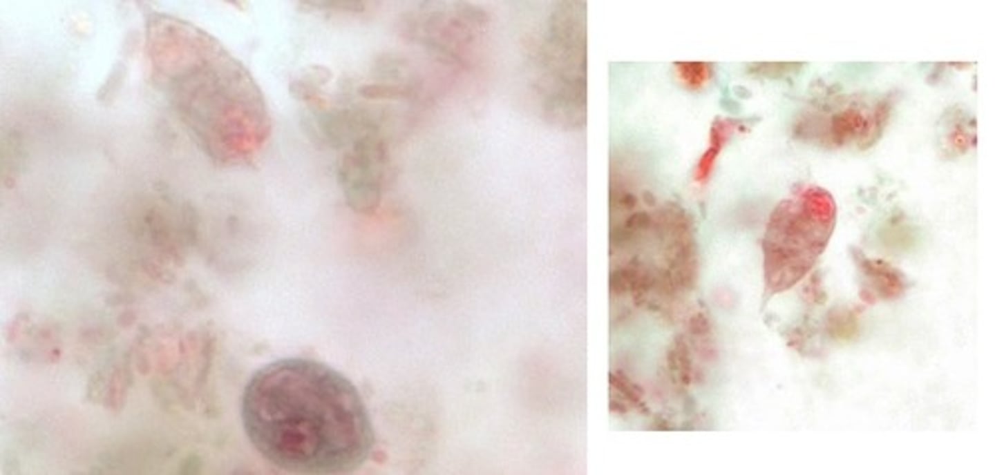 <p>• Cyst (lower)</p><p>o "Shepherd's crook"</p><p>cytostome</p><p>• Trophozoite (upper</p><p>and right)</p><p>o Pear shaped</p><p>o Anterior end is</p><p>rounded, nucleus</p><p>o Posterior end is</p><p>tapered</p><p>o "Shepherd's crook"</p><p>cytostome</p>