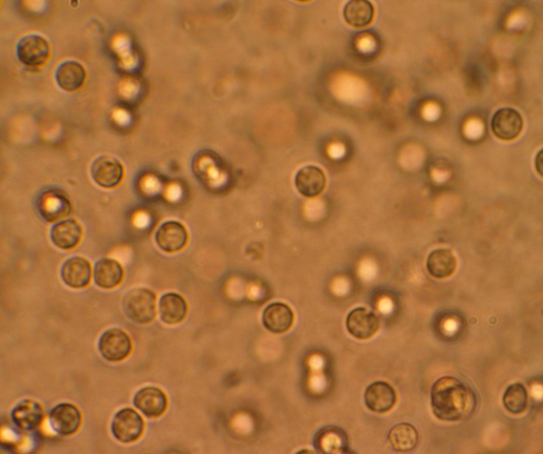 <p>Reported as average/10 HPF</p>