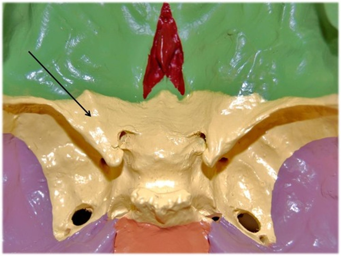 <p>Name this part of the sphenoid bone.</p>