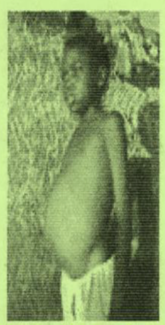 <p>Disease; caused by?</p>
