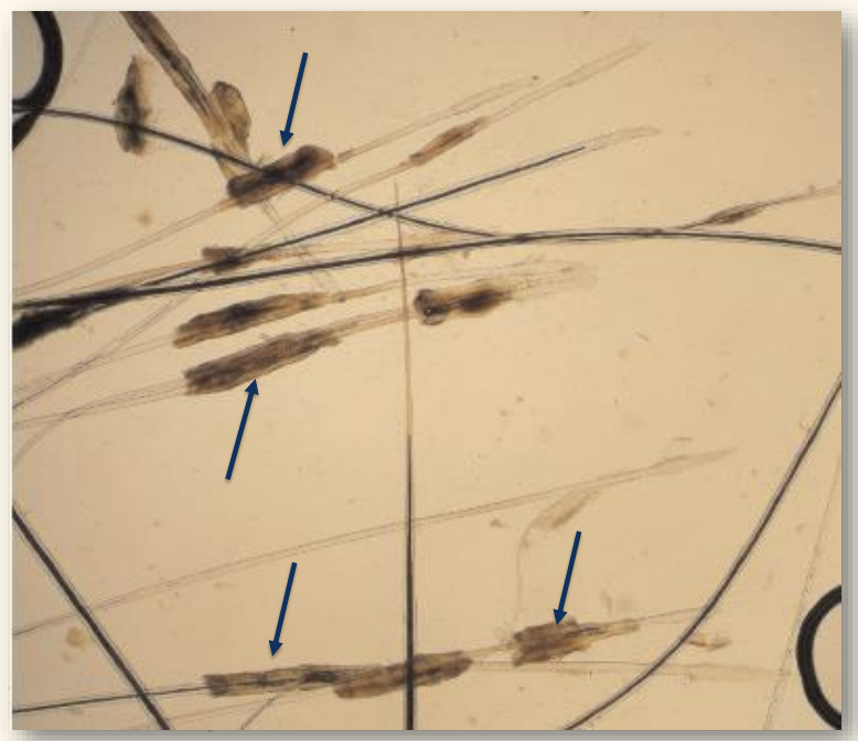 <p>What are these structures?</p><p>what can they indicate?</p>