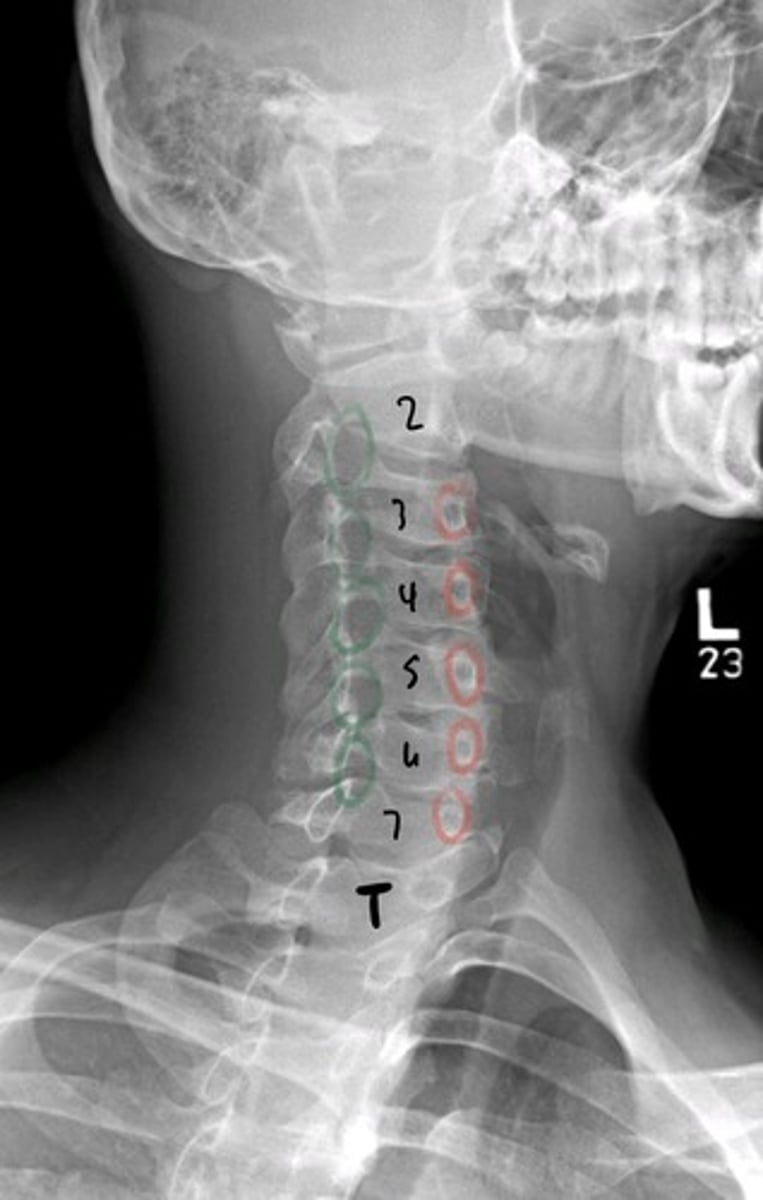 <p>what are the red circles indicating?</p><p>what are the green circles indicating?</p>
