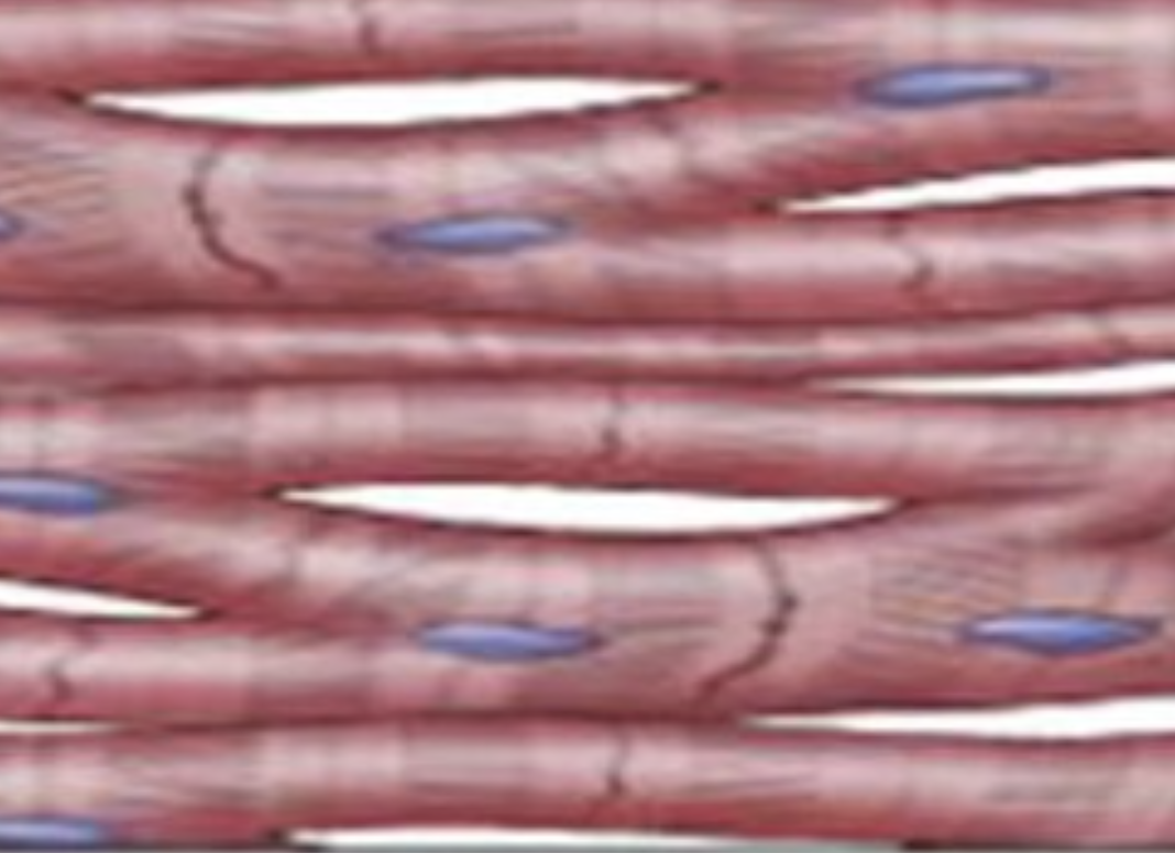 <p>what type of muscle tissue is this?</p>