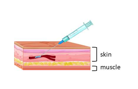 <ul><li><p><span><span>The drug can be administered by a bolus injection </span></span></p></li><li><p><span><span>or by slow infusion (by gravity or infusion pump). </span></span></p></li></ul><p></p>