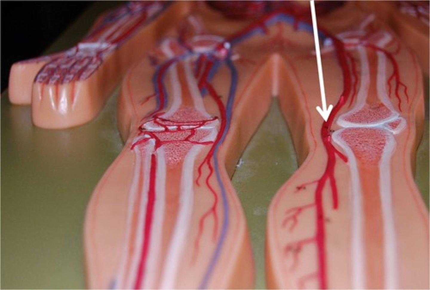 <p>continuation of femoral arteries that begin in the popliteal region and end in the upper leg where they divide into the anterior and posterior tibial arteries</p>