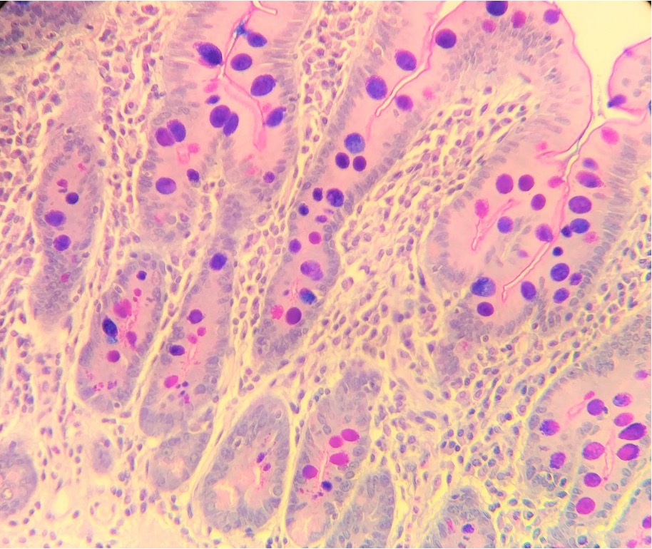 <ul><li><p>Pink = neutral polysaccharides </p></li><li><p>Purple = mix of neutral and acidic </p></li><li><p>Blue = acidic only</p></li></ul><p></p>