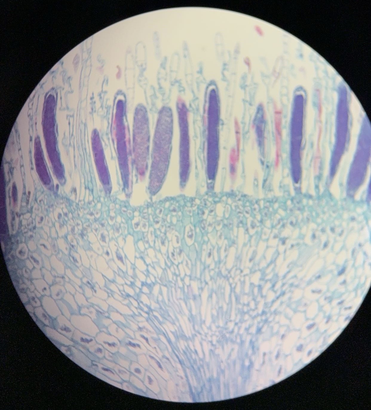 <p><span>What is this organism?</span></p>