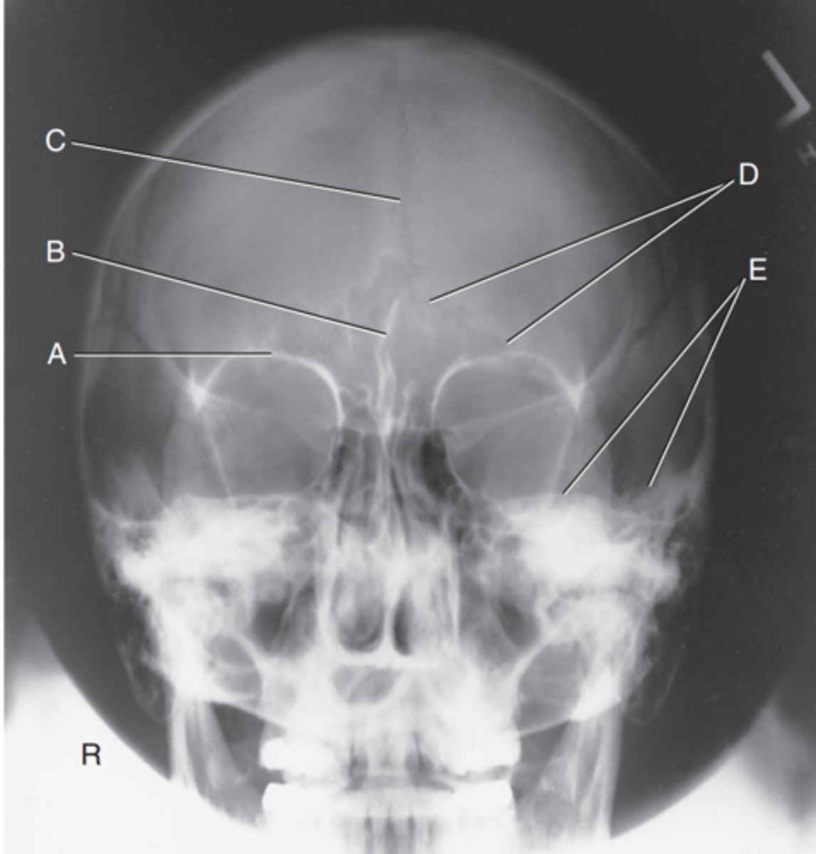 <p>Label D</p>