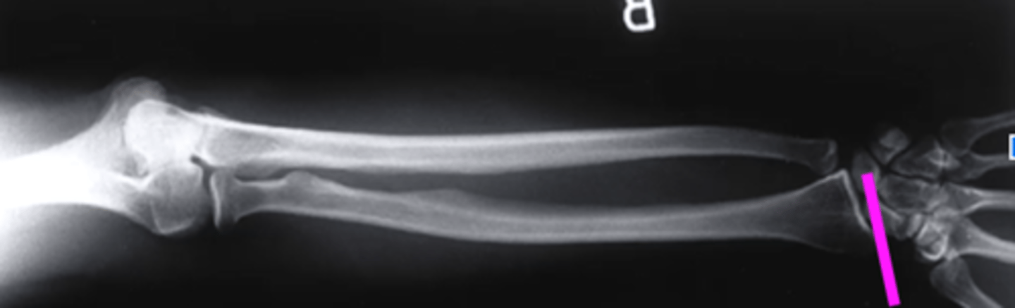 <p>what does this pink line point to?</p>