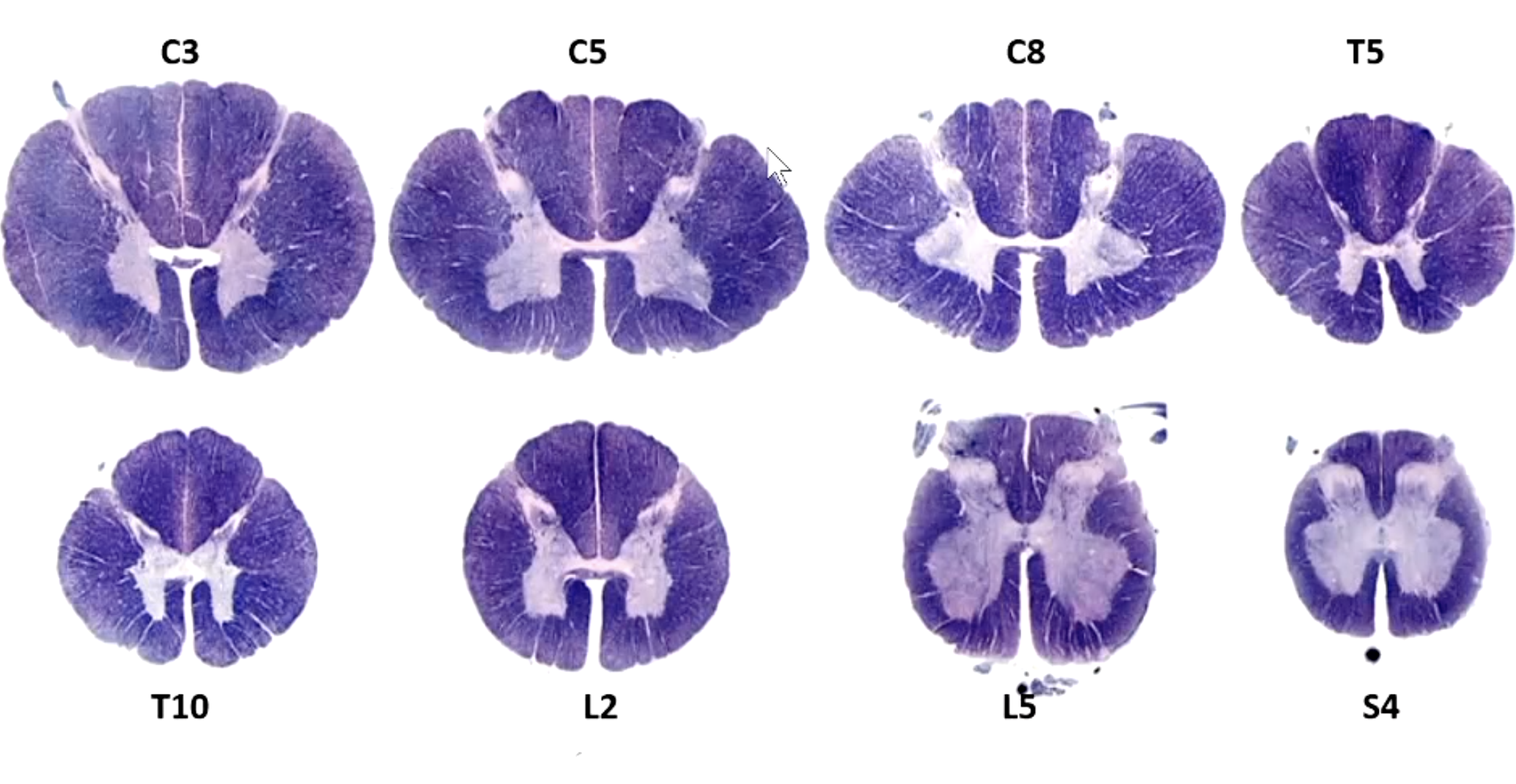 <p>which spinal levels depicted here depict BOTH fascilicus cuneatus and gracilis? which ones only have 1</p>