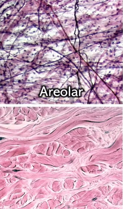 <p>Which connective tissue is this?</p>