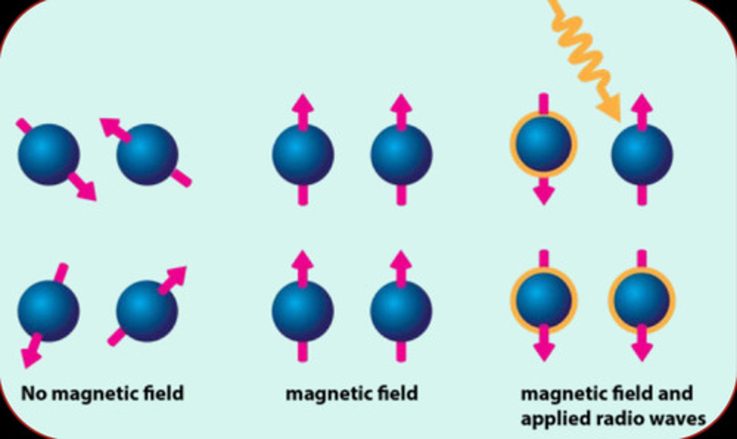<p>MRI Principles:</p><p>All tissues have lots of hydrogen protons because they are made of H2O. The magnet is applied and protons are excited by a _____ pulse.</p><p>Pulse removed -&gt; protons relax -&gt; emits signal</p><p>Protons in different tissues relax differently (superior contrast in tissues).</p>