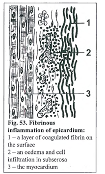 <p><strong>Pericarditis fibrinosa</strong></p><img src="https://knowt-user-attachments.s3.amazonaws.com/865b893f-3082-46c5-ad5f-db320f92970a.png" data-width="100%" data-align="center"><p></p>