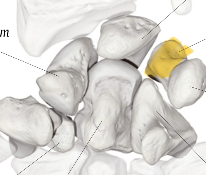 <p>Os triquetrum</p>