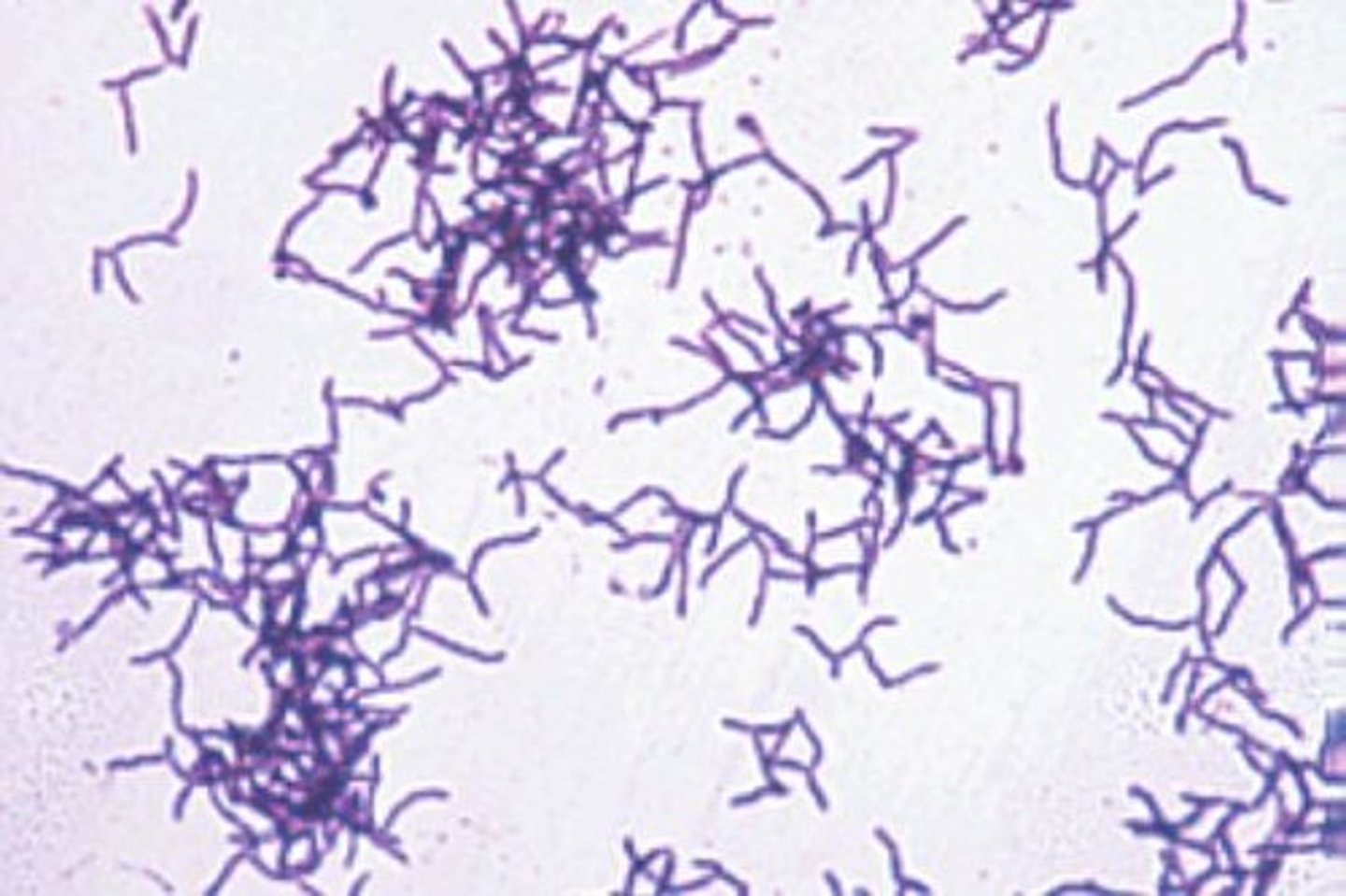 <p>1. The crystal violet turns the cell purple.</p><p>2. The iodine turns the cell a blue-purple color.</p><p>3. The cell remains the blue-purple color after the alcohol wash.</p><p>4. The safranin does not affect the color of the cell, the cell remains dyed blue-purple.</p>