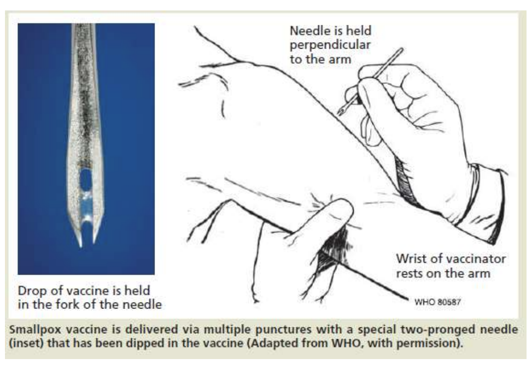 <p><strong>multiple punctures using special 2-pronged needle (inset) dipped in the vaccine</strong></p>