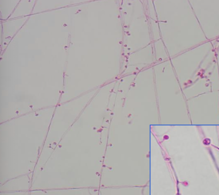<p>Blastomyces dermatitidis mold</p>