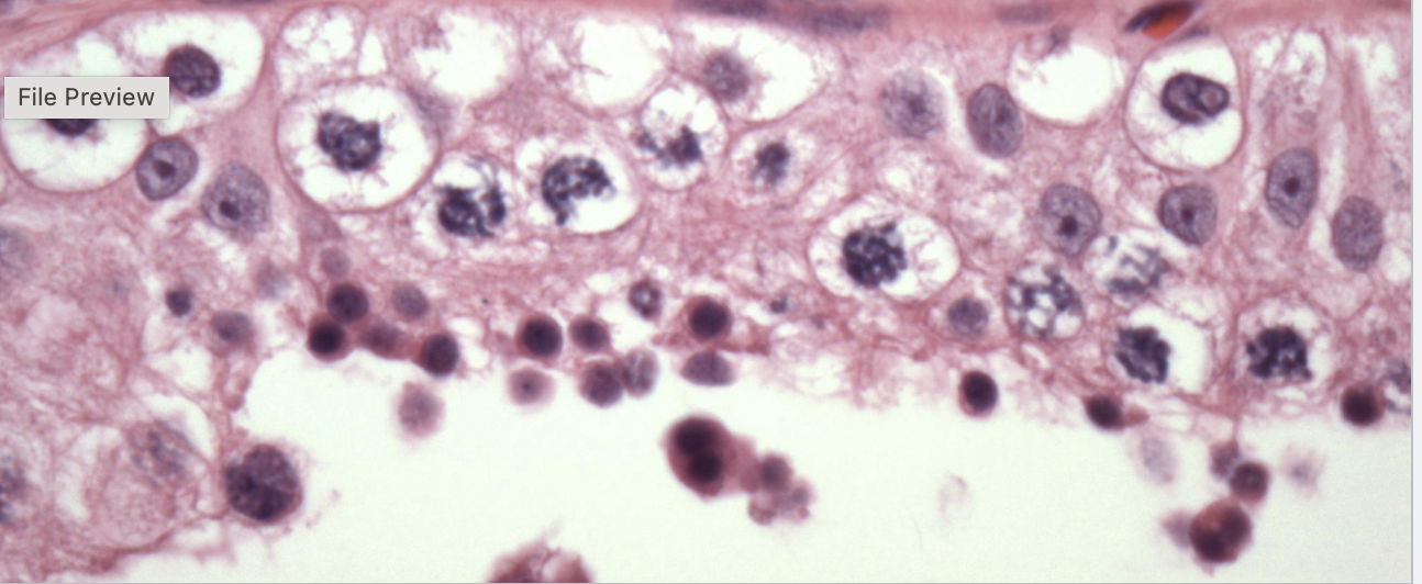 <p>Seminiferous tubule cell types</p>