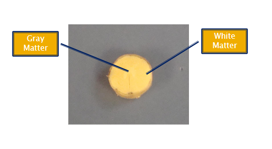<ol><li><p>Gray Matter</p></li><li><p>White Matter</p></li></ol><p></p>
