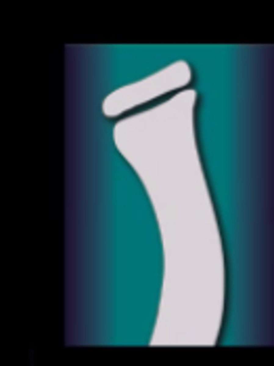 <p>bowing appearnce</p>