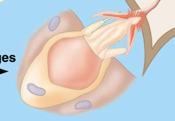<p>Organelle in Cnidocytes that eject a stinging thread to entangle or paralyze prey; some extremely harmful to humans</p>