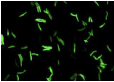 <p>de bacillen kleuren fluorescent</p>
