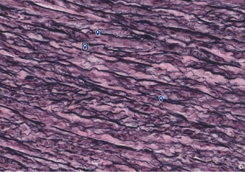<p>identify area of histological slide, type of CT, and identify structures</p>