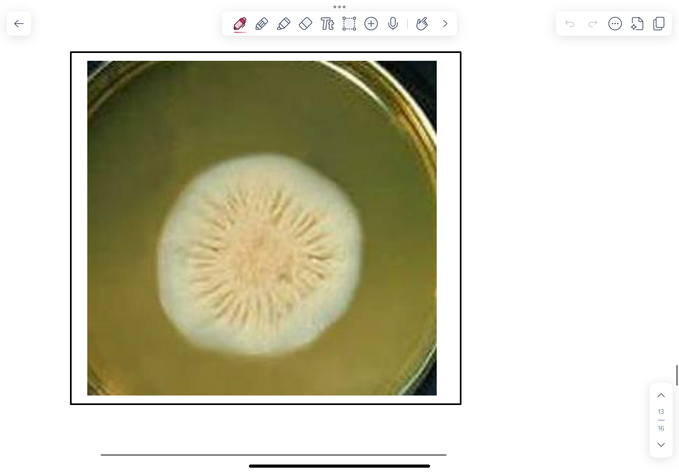 <p>NOTE fuzzy, mold-like colonies on the SAB plate incubated at 200C</p>