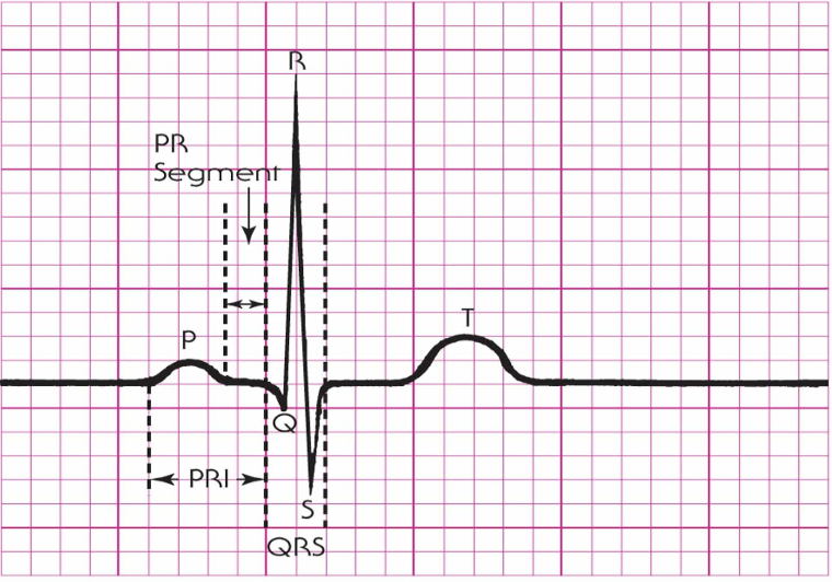<ul><li><p>P wave → QRS → T wave</p></li><li><p>Represents depolarization → contraction → repolarization → rest</p></li></ul><p></p>
