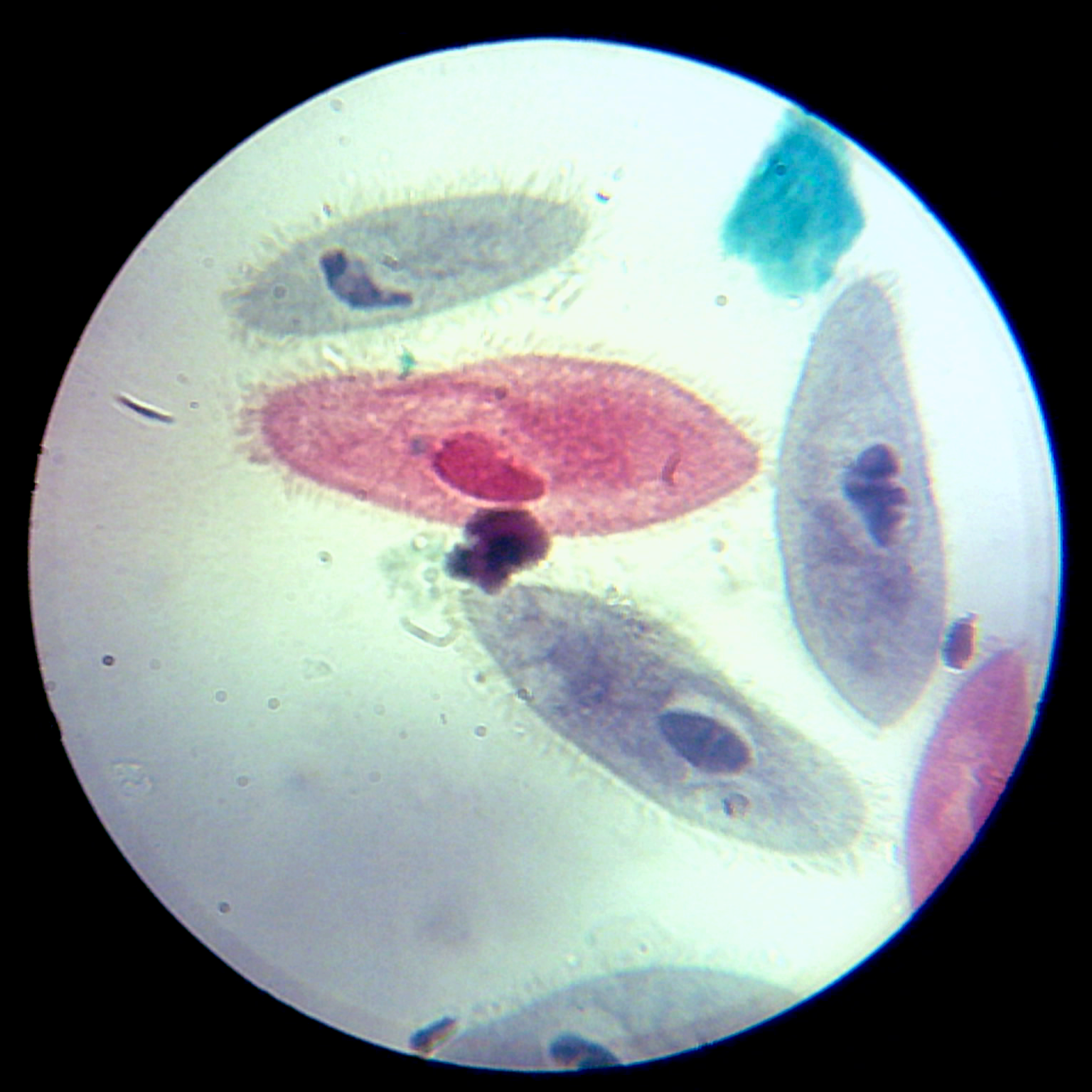 <p>ciliate</p><p>importance = part of food chain</p>