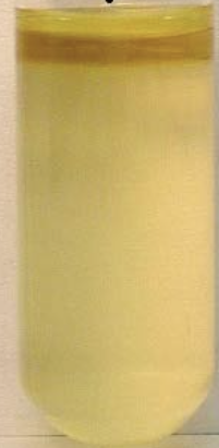 <p>Is this a positive or negative Indole test?</p>