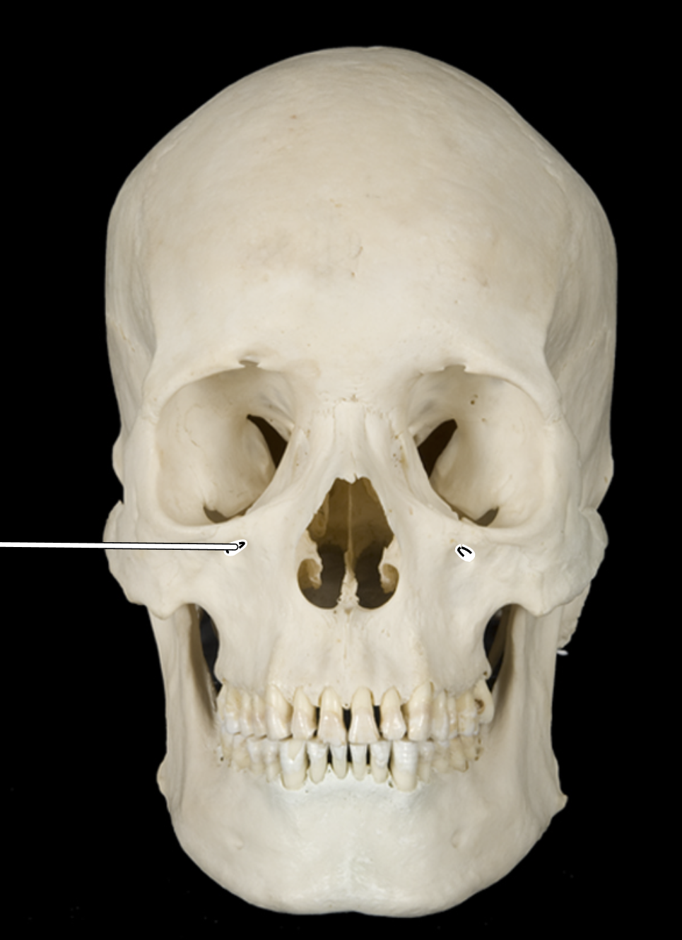 <p>Name the highlighted portion.</p><p>(Skull, anterior view).</p>