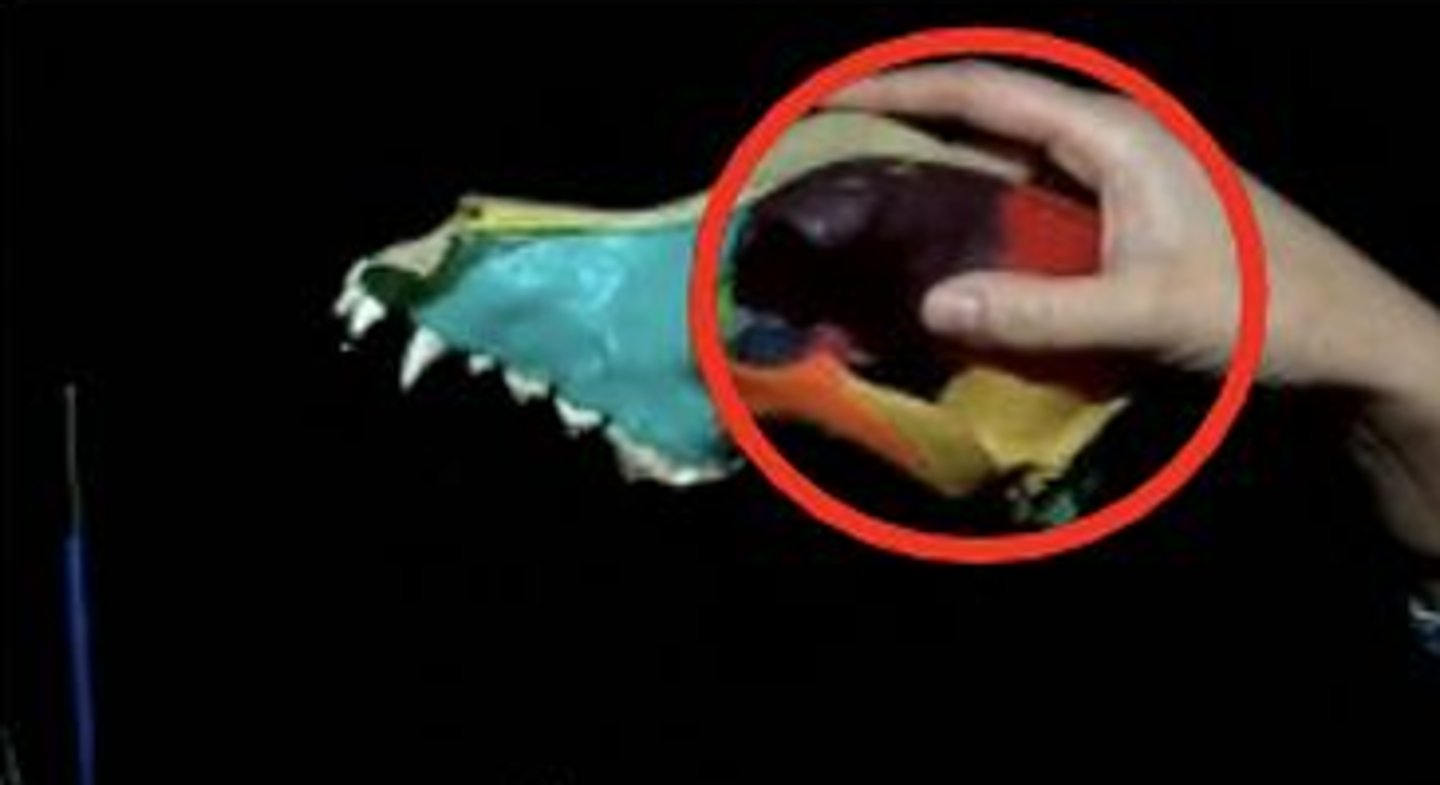 <p>the portion of the skull that encloses the brain</p>