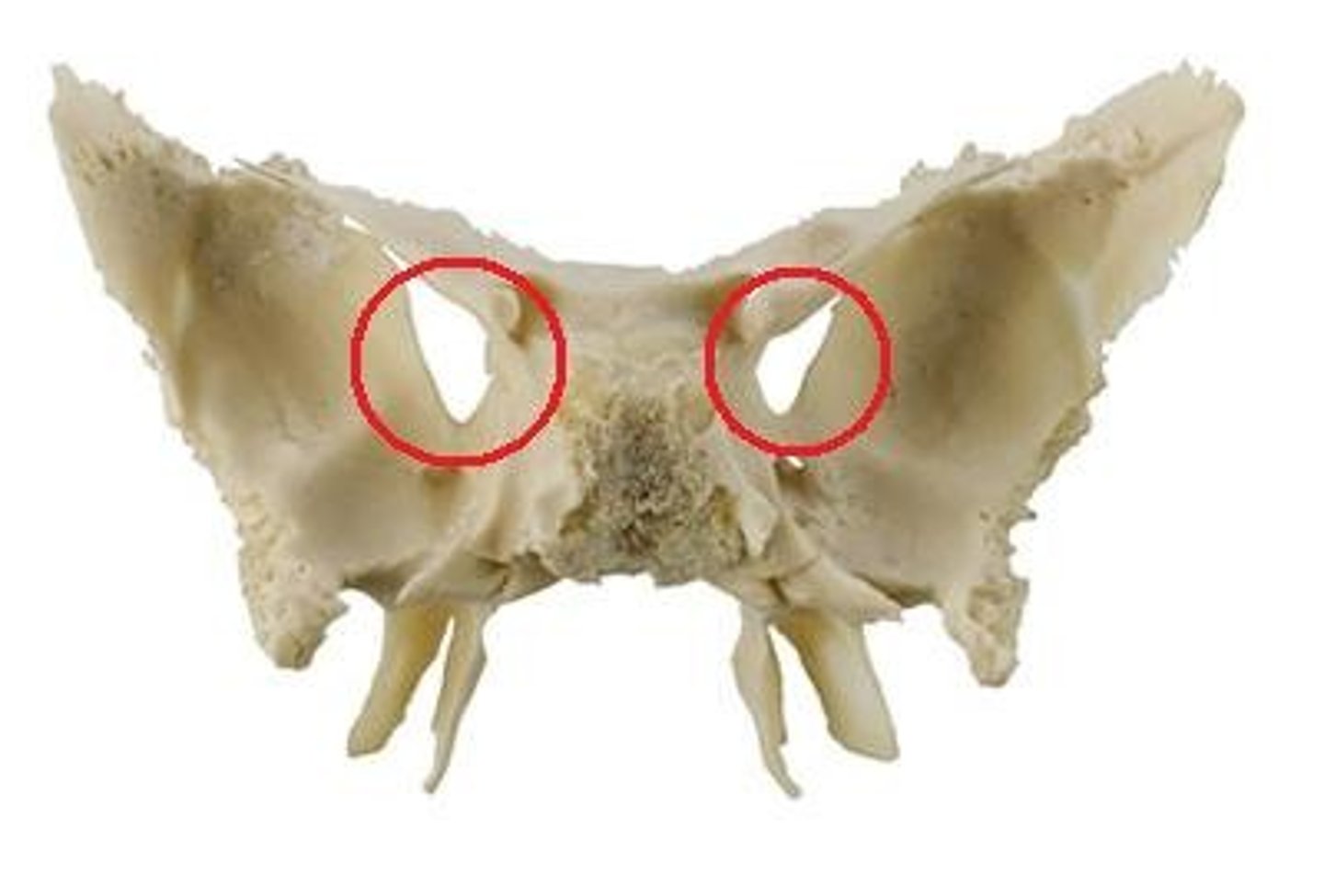 <p>Name this opening of the sphenoid bone.</p>