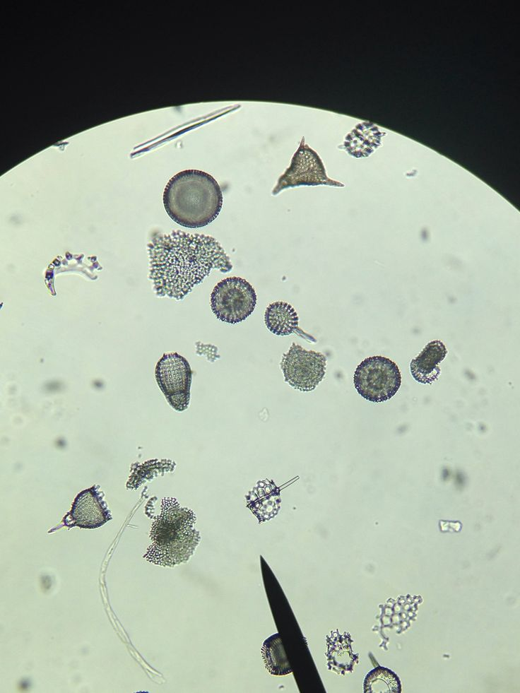<p><strong>Phylum Radiolaria</strong></p>