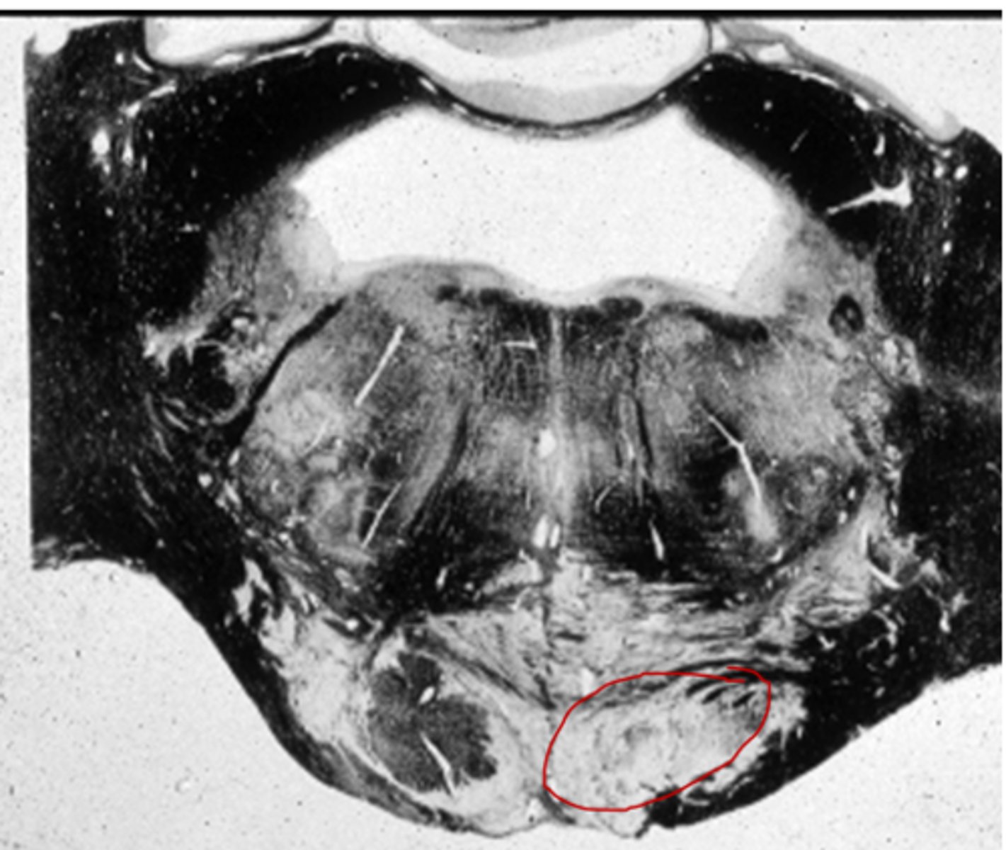 <p>serves as relay striations between cerebral cortex &amp; cerebellum in regards to motor coordination</p>