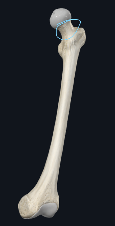 <p>What is this part of the femur called</p>