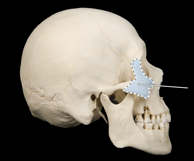 <p>Name this bone.</p><p>(Skull, lateral view).</p>
