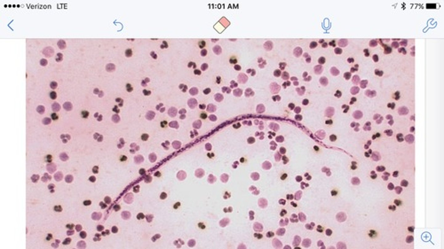 <p>Sheath</p><p>Nuclei extend continuously into the tail</p>
