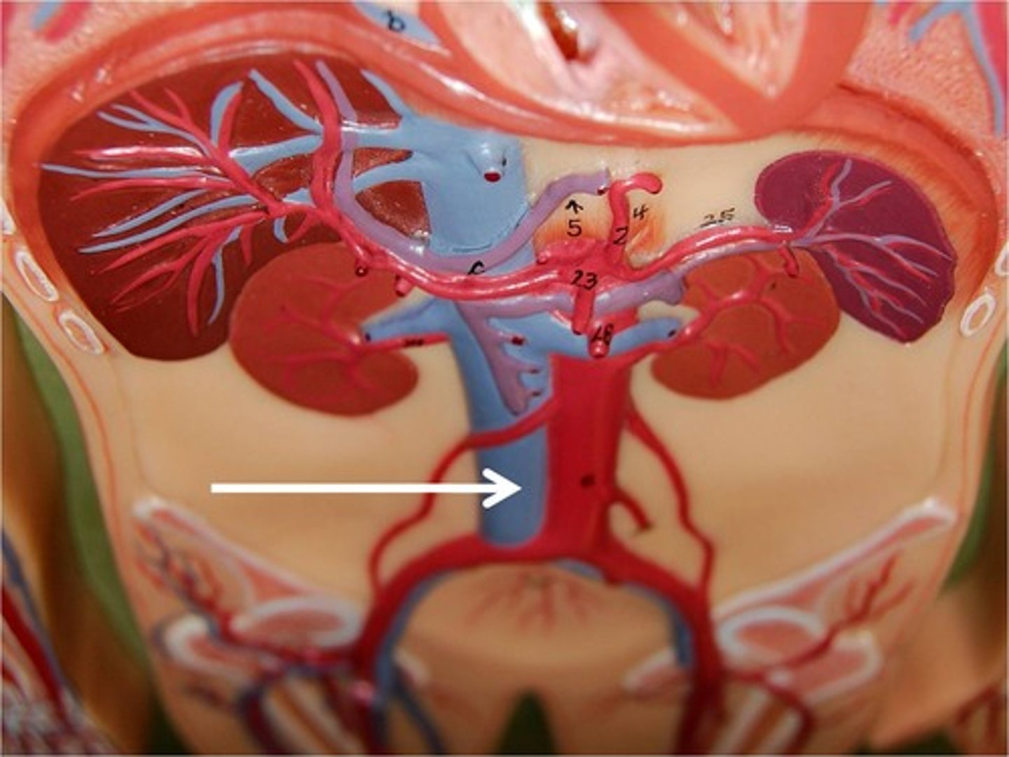 <p>A vein that is the largest vein in the human body and returns blood to the right atrium of the heart from bodily parts below the diaphragm.</p>