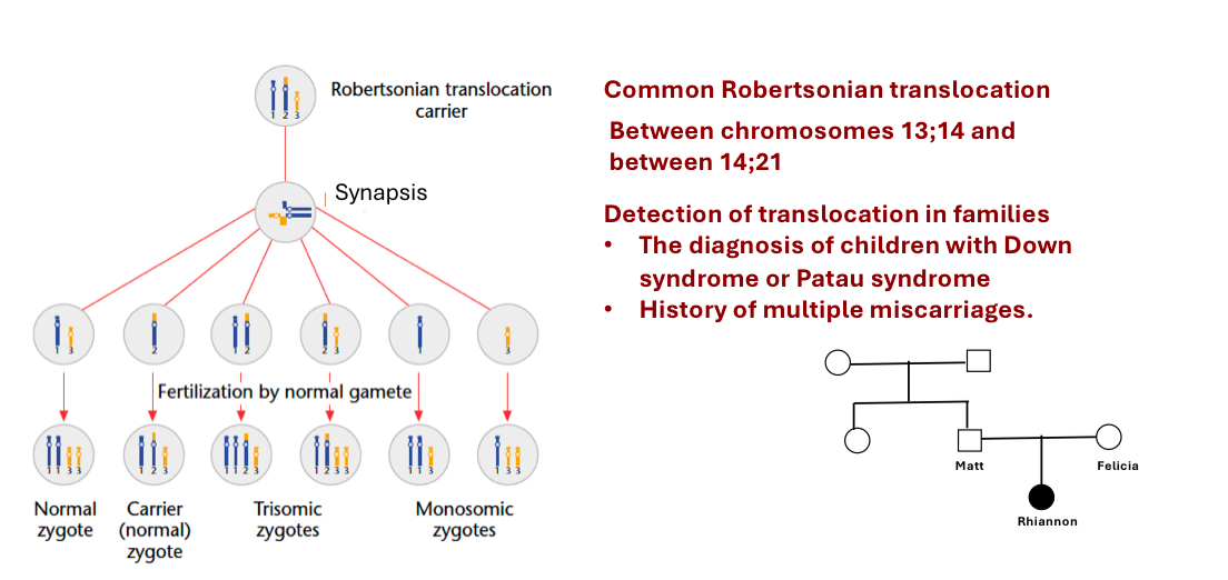 <p>Robertsonian translocations are unique types of <strong><u>whole-arm translocations</u></strong>.&nbsp;</p><p>two acrocentric (long arms fuse, loses short stubby arms) chromosomes fuse at the centromere, causing a REDUCTION in the <u>chromosome number to 45</u>, but usually do not cause phenotypic effects</p><p>This can lead to aneuploidy or balanced carriers.</p><p>Carrier individuals will not generally show any physical phenotypic effects until <u>reproduction </u>example translocation:</p><ul><li><p>Down syndrome&nbsp;</p></li><li><p>Patau syndrome</p></li></ul><p>Common Robertsonian translocation between chromosomes 13;14, and between 14;21</p>