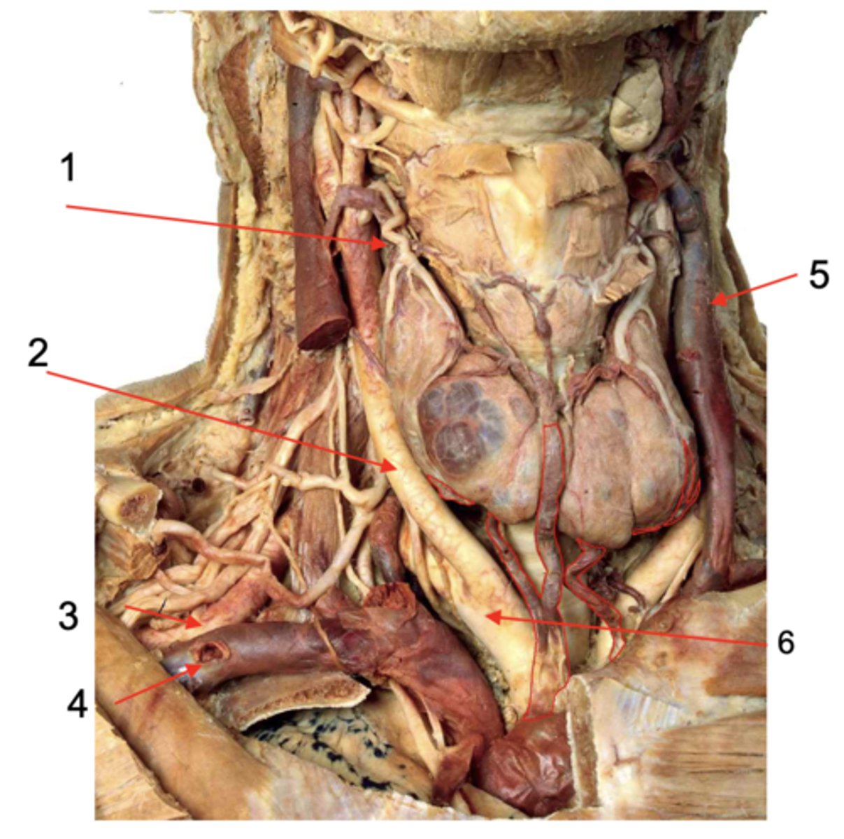 <p>Identify the structure at #4</p>