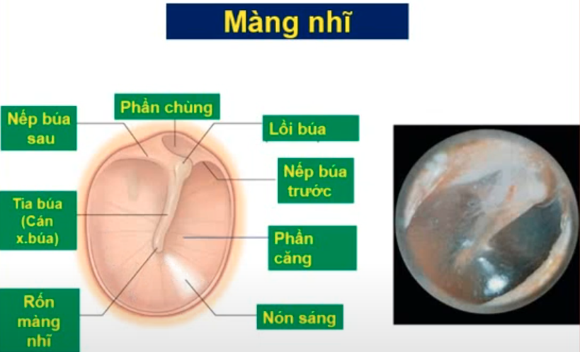 <p>Màng nhĩ được chia làm 2 phần nào ?</p><p>Chi tiết nào giới hạn 2 phần đó ?</p><p>Chỗ lõm nhất của màng nhĩ là gì ? </p><p>Nhìn từ ngoài vào có thể thấy được chi tiết gì ? </p><p>Màng nhĩ được chia làm mấy lớp ? </p>