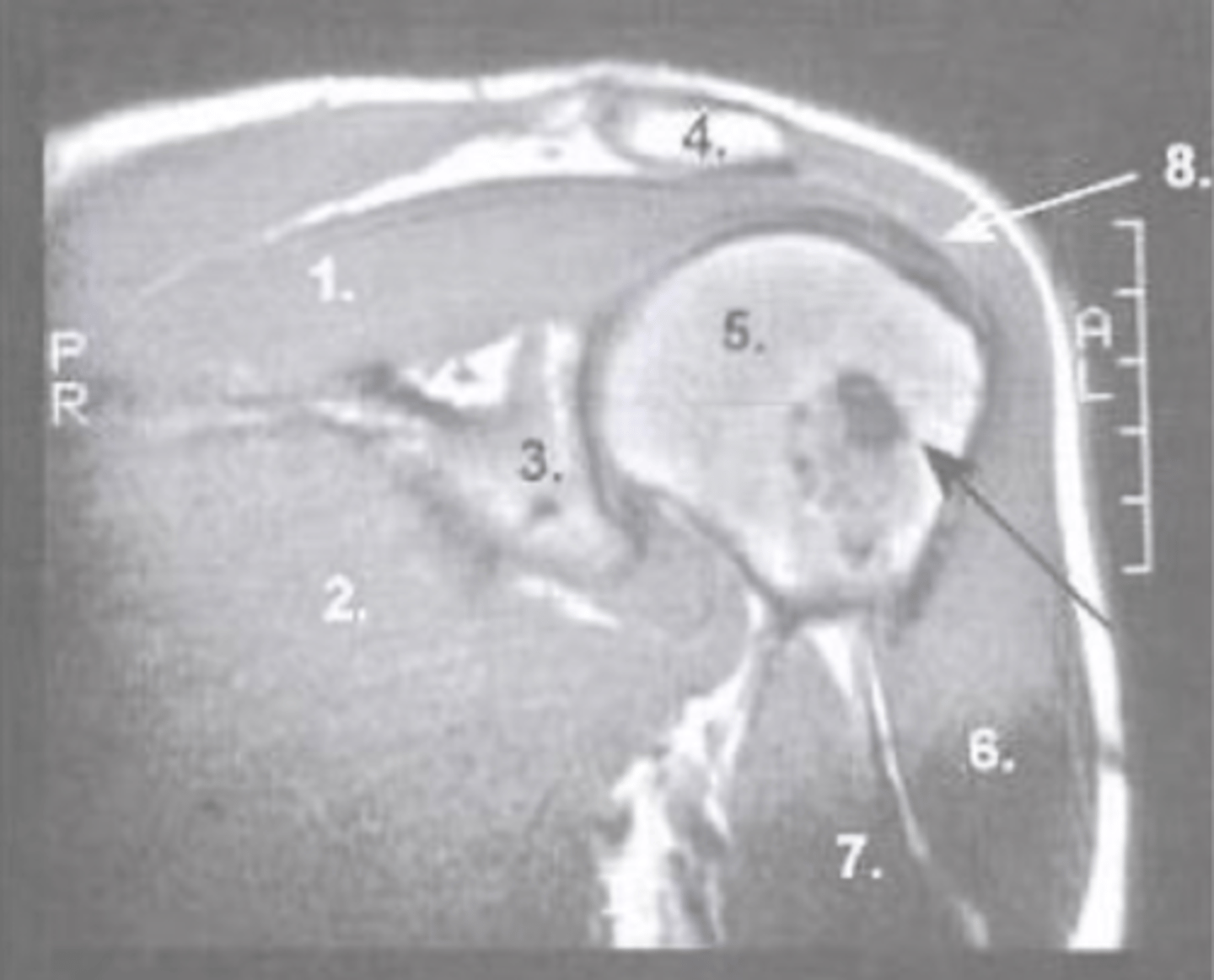 <p>What is number 4?</p>