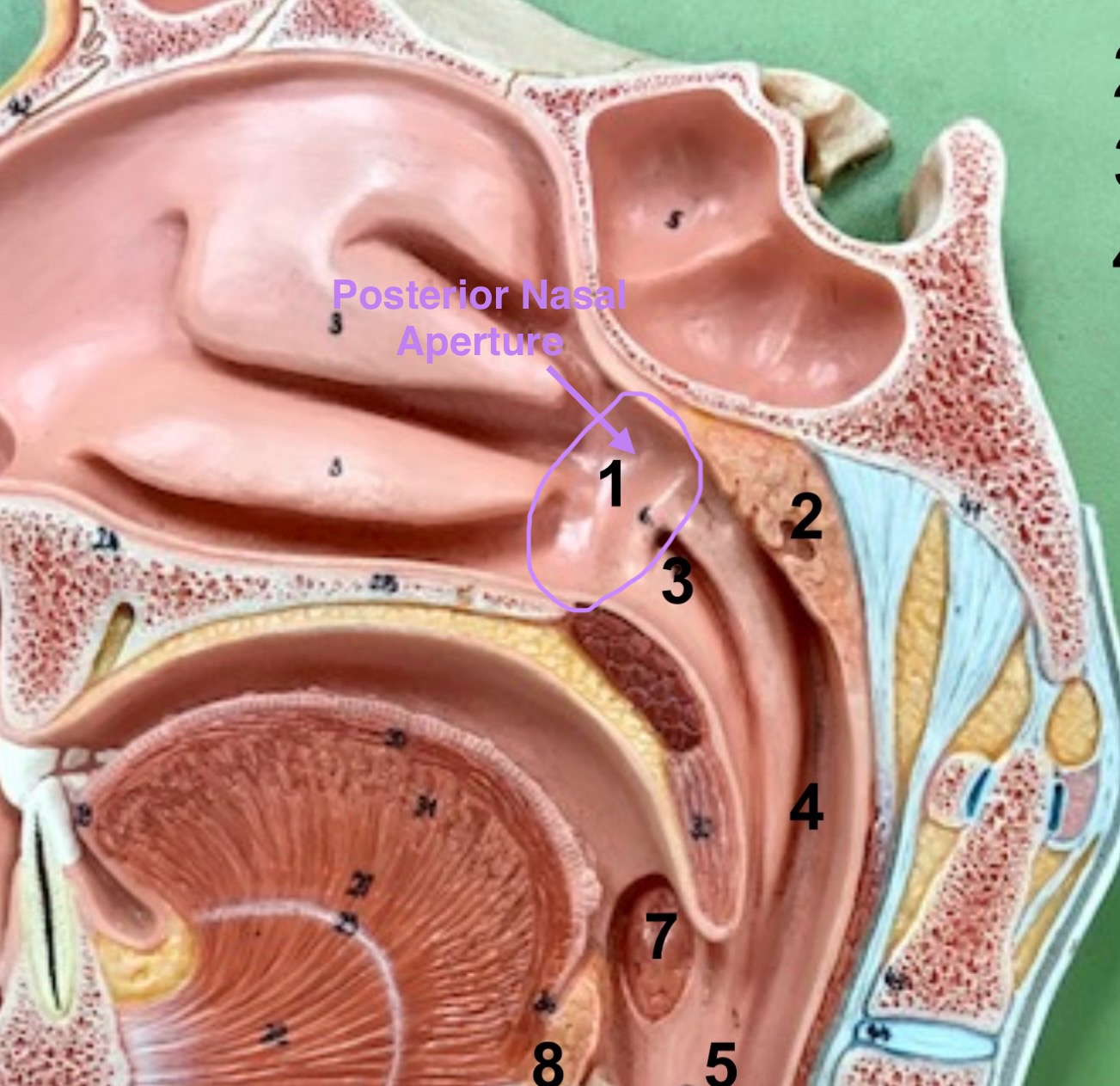 <p>open passageway at the end of the nasal cavity leading into the pharynx</p>