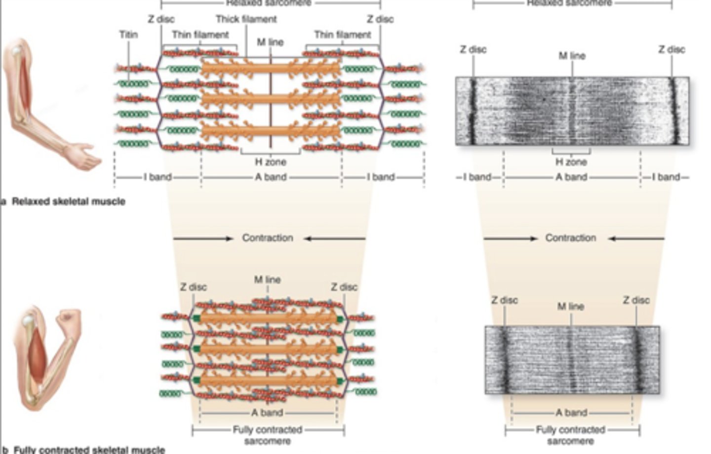 <p>During sarcomere shortening/muscle contractions, what band stays the same length?</p>