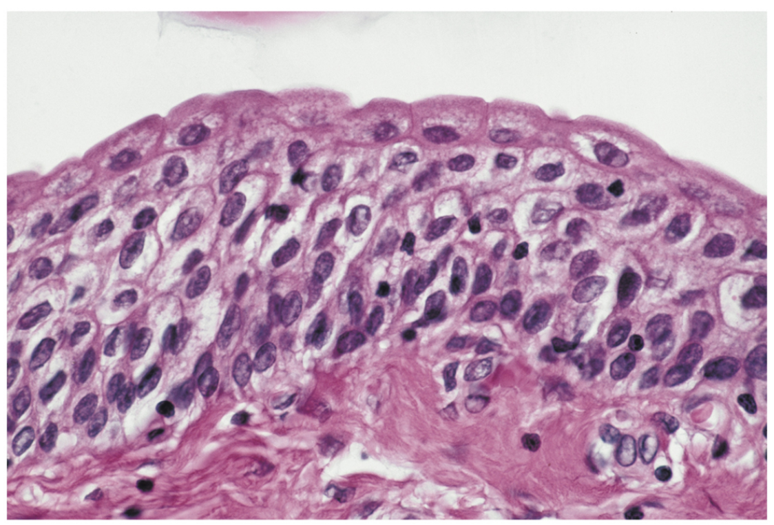 <p>Transitional epithelium.</p>