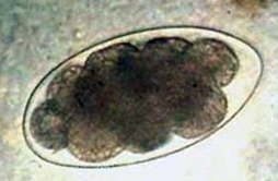 <p>List the egg TYPE for the nematode egg shown.</p>