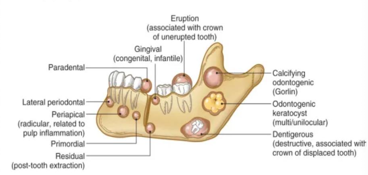 <p>Define a cyst</p>